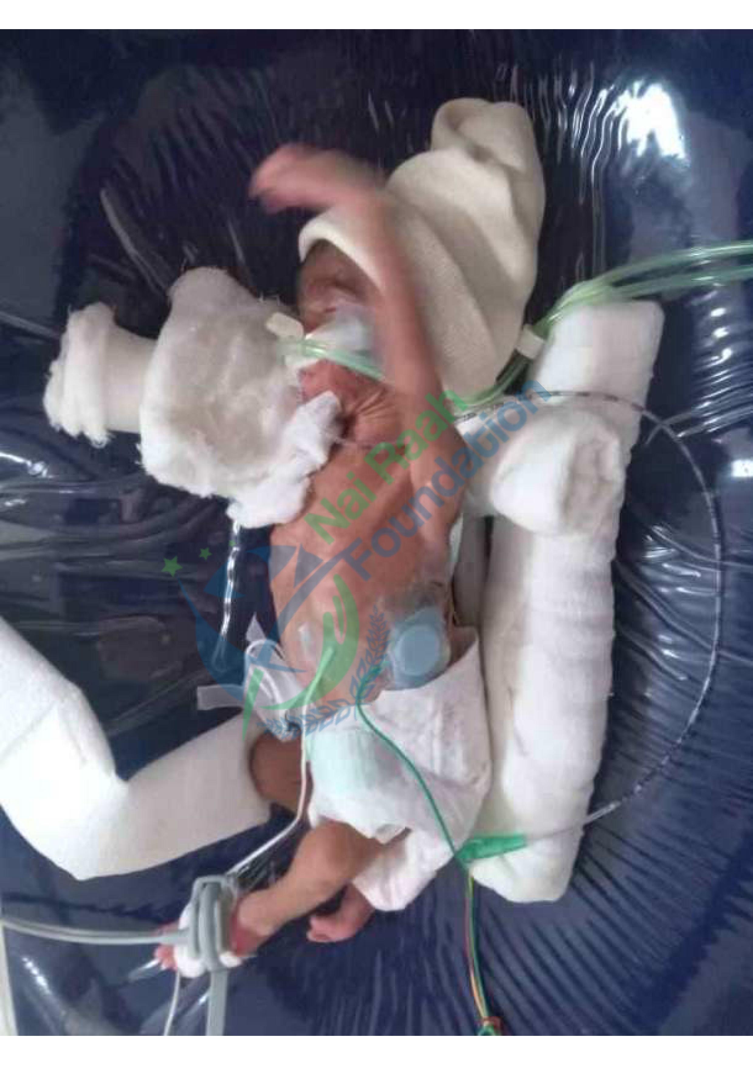 B/O Geeta More Premature birth