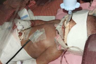B/O Vidhya Singh : Heart Disease New Born 10 days old Baby Girl