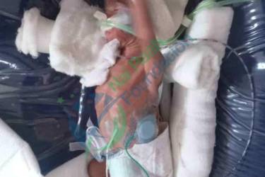 B/O Geeta More Premature birth New Born 1 week old Baby Girl